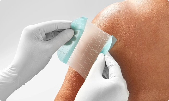 Comfeel® Plus 