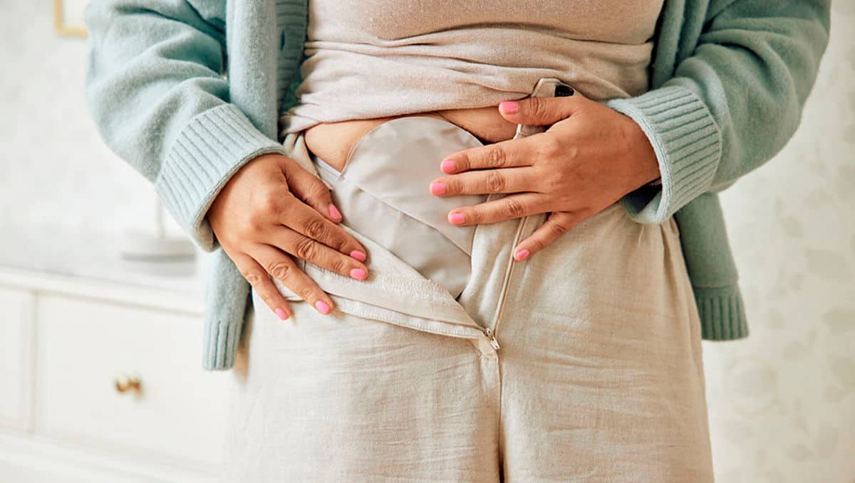 SenSura® Mio ostomy bags and plates