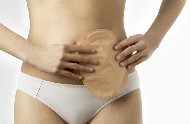 SenSura® ostomy bags and plates
